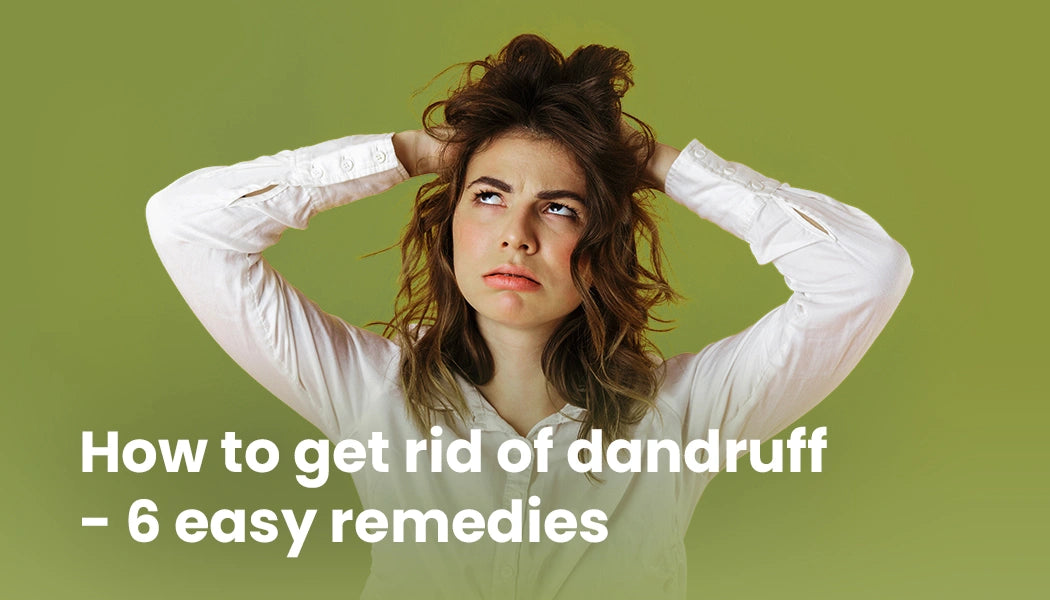 How to Get Rid of Dandruff – 6 Easy Solutions