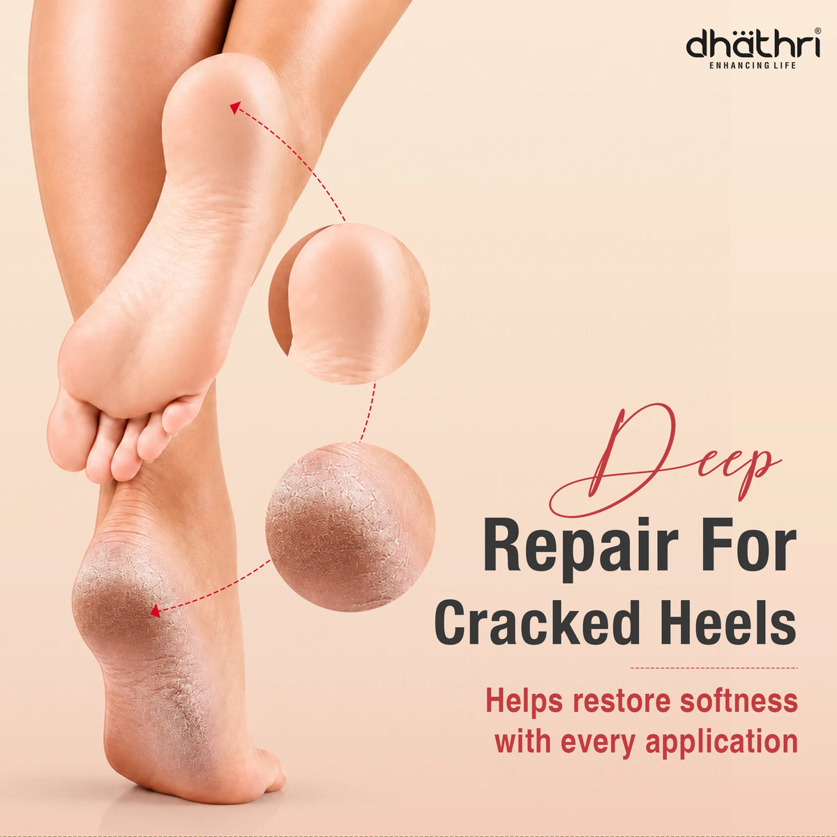 Dhathri crack foot cream