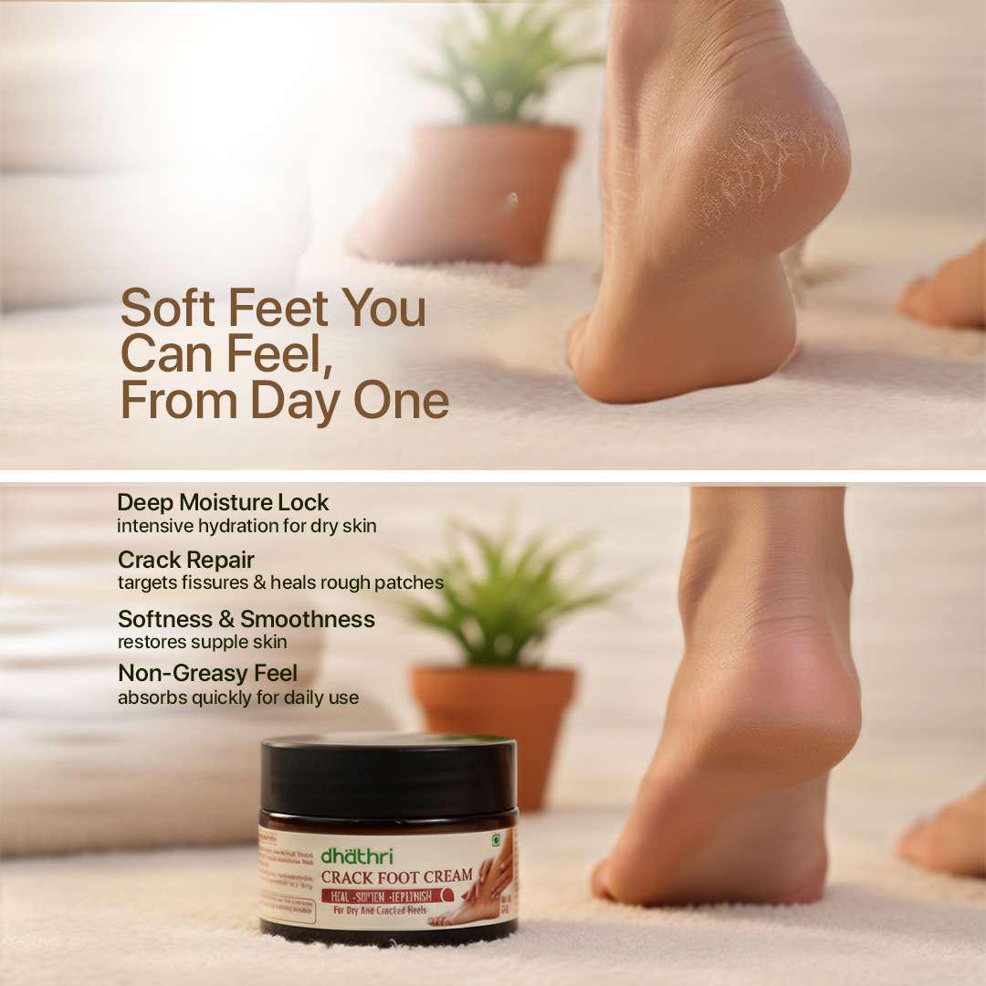 Dhathri crack foot cream